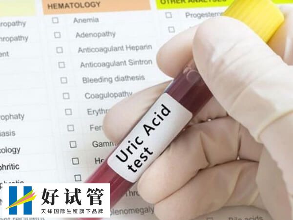 试管促排促黄体生成素是不是越低越好