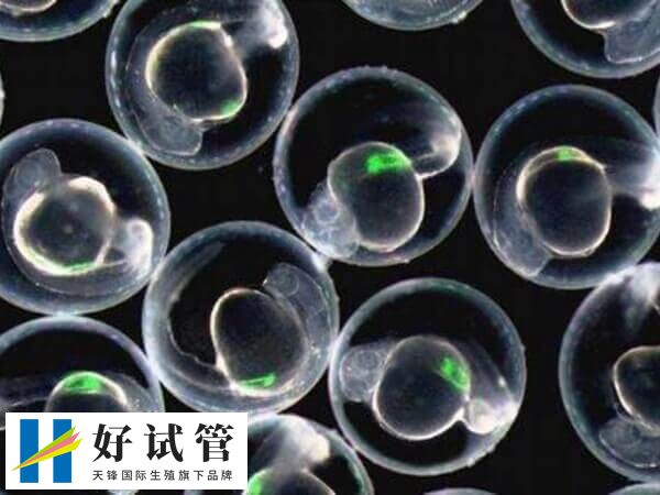 鲜胚移植12天有什么感觉