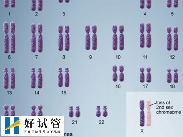 染色体缺失做试管要多少钱