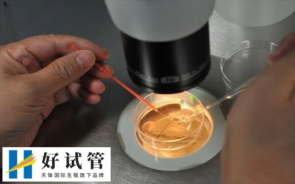 试管成功率和哪些因素有关