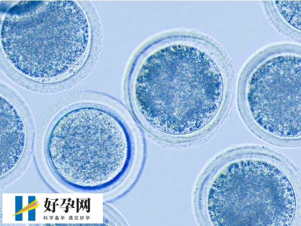 黄体期促排方案适合哪些人群