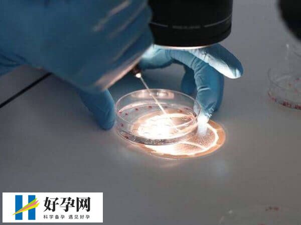 试管养囊要收费